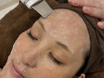 ミル(milu)の写真/【スチーム×吸引×保湿】最強毛穴洗浄フェイシャルでつるんとたまご肌に◇毛穴の詰まり・開き・黒ずみに◎