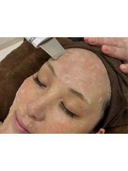 毛穴ケアをしたい