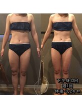 カルム エ コンポーゼ(Calme et Compose')/痩身セルゼロ／下半身12回