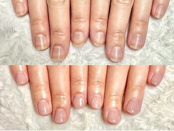 グラシナ なんば店/深爪/自爪育成/フィルイン