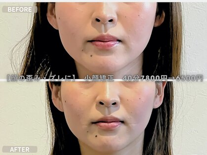 ラーナビコツ(RANA-bikotsu)の写真