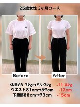 くさば整骨院/25歳女性/ダイエット3か月コース