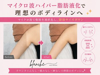 オリエンタルローザ 表参道(Oriental Rosa)/マイクロ波ハイパー脂肪液化術！