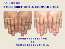 プラスワン(+1)の雰囲気（深爪、爪噛み、縦割れ、形...爪のお悩みを改善します[池袋]）