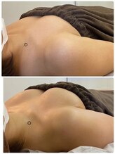 ラビス(RAVIS)/20代☆ふっくらバストに　恵比寿