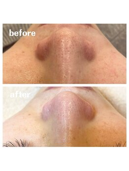 シエル(ciel)/before→after