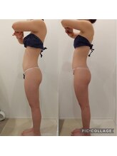 クレール アオヤマ(CLAIRE AOYAMA)/二の腕から足まで全身痩身