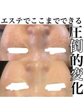 サロンツキ(salon tuki)/【最新光機器】症例