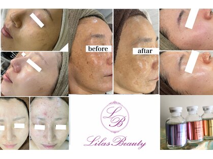 リラビューティー(Lilas Beauty)の写真
