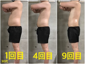 ペリー(PELLY)/男性30代 before after