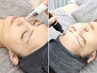 【毛穴でお悩みの方へ！】ハイドラ毛穴洗浄×高濃度アンプル導入