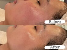 シーン(Sheen)の雰囲気(赤みやくすみの抜けたお肌ですっぴんが輝く。)