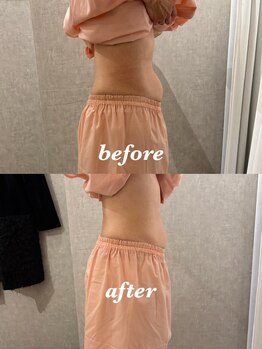 マホロバ セカンド(mahoroba 2nd)/EMSプラス腸活マッサージ