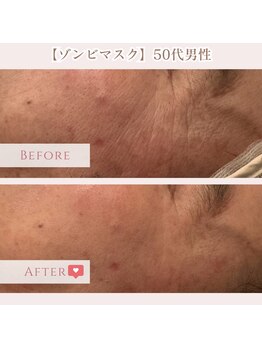 エクラ アン(eclat.un)/ゾンビマスク 50代男性