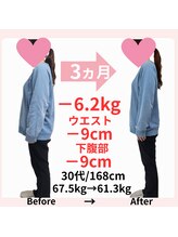 おもいやり鍼灸治療院 モーイ(mooi)/鍼灸痩身ダイエット