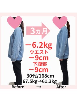 おもいやり鍼灸治療院 モーイ(mooi)/鍼灸痩身ダイエット