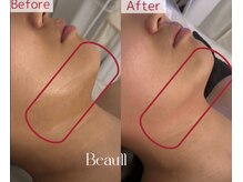 ロイヤル ビューティー サロン(Royal Beauty Saloon)の雰囲気（スッキリフェイスラインの変化◎痩身/たるみ/ほうれい線/小顔）