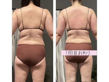 エスデザイン(es design)/リンパマッサージ/デトックス