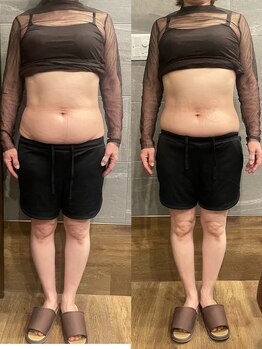 長寿鍼灸院 長寿整骨院/EMS<お腹集中コース>