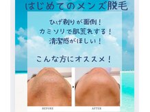 ルッカヘアガーデンバイラッシュゴールド(RUCCA HAIR GARDEN by LUSH GOLD)の雰囲気（メンズ脱毛！爽やか印象に♪面倒なヒゲ剃りから解放されたい方！）