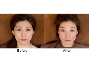 こじま 富雄団地接骨院/Before&After