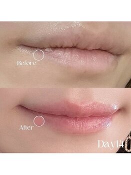 オンユ(ON’U)/ローマピンク