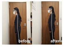 リファイン整体院 国分寺店/姿勢改善、肩こり、腰痛、整体