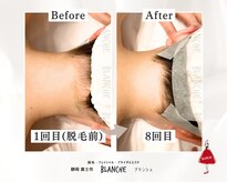 ブランシュ(BLANCHE)