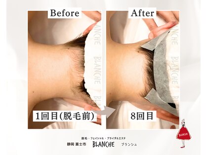 ブランシュ(BLANCHE)の写真