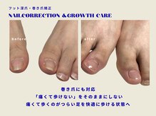 プラスワン(+1)の雰囲気（深爪・巻き爪、足のトラブルに対応☆フット深爪矯正[池袋]）