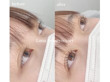 ラナビューティリゾート(Lana Beauty resort)/アップラッシュリフト