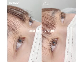 ラナビューティリゾート(Lana Beauty resort)/アップラッシュリフト