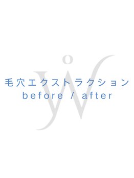 ウォーマル(warmaL)/