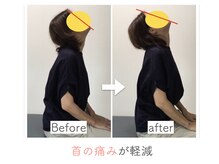 整体あゆむ 立川店/before after５