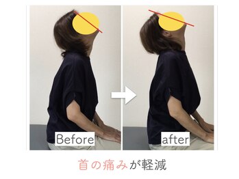 整体あゆむ 立川店/before after５