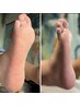 フットケアナチュラルケア