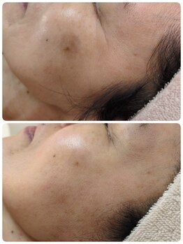 ラヴィアンローズ 蒲郡店(& La vie en Rose)/シミ