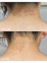 エース(ACE.)/見た目の印象大きくアップ♪