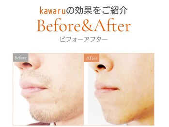 カワル(kawaru)/毎日のひげ剃り＋青ひげ解消へ♪