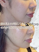 ルミライ(Lumirai)/40代からの本格美容に！