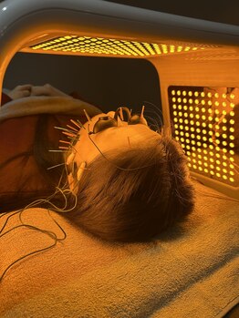 ハリエイド(HARI AID)/光LED美容鍼【美白特化型】