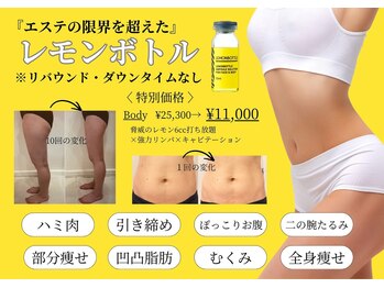 イーズ ミュゼ &nbsp;ららぽーと横浜店の写真/部位パーソナルもOK♪短期集中・リピーター満足度No.1の『ボディ大改造★痩身体験コース¥5500』