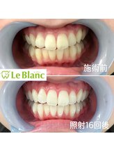 ルブラン 奈良店(Le Blanc)/フリーパスは最低保証付き♪