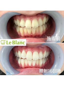 ルブラン 奈良店(Le Blanc)/フリーパスは最低保証付き♪