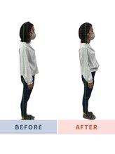 姿勢矯正院/頭痛も姿勢