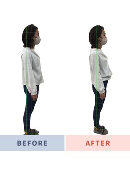 姿勢矯正院/頭痛も姿勢