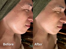 シゼン 恵比寿店(S1ZEN+)/ハーブトリートメント1回