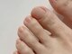 クリーム(Nail Atelier CREAM)の写真/≪話題の巻き爪ケア!!HeySwitch認定サロン≫韓国発祥の特許取得特殊ジェルで巻き爪がケア出来ます!!