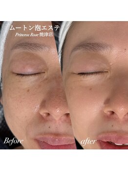 プリンセスローズ 焼津店(Princess Rose)/ムートン泡エステ　¥7800→¥3980