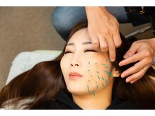 北梅田美容鍼灸院/【大阪/梅田】美容鍼灸